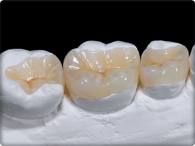 Restoratif dolgu nedir?