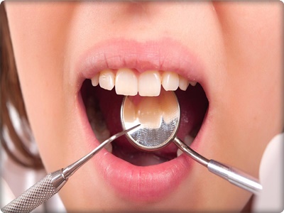 Restoratif diş tedavisinde Ne yapılır,