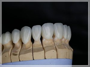 Emax diş ömrü